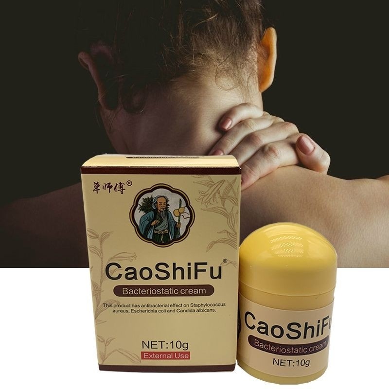 CAOSHIFU Psoriasis Eczma Cream For All Kinds Of Skin Problems Patch ...