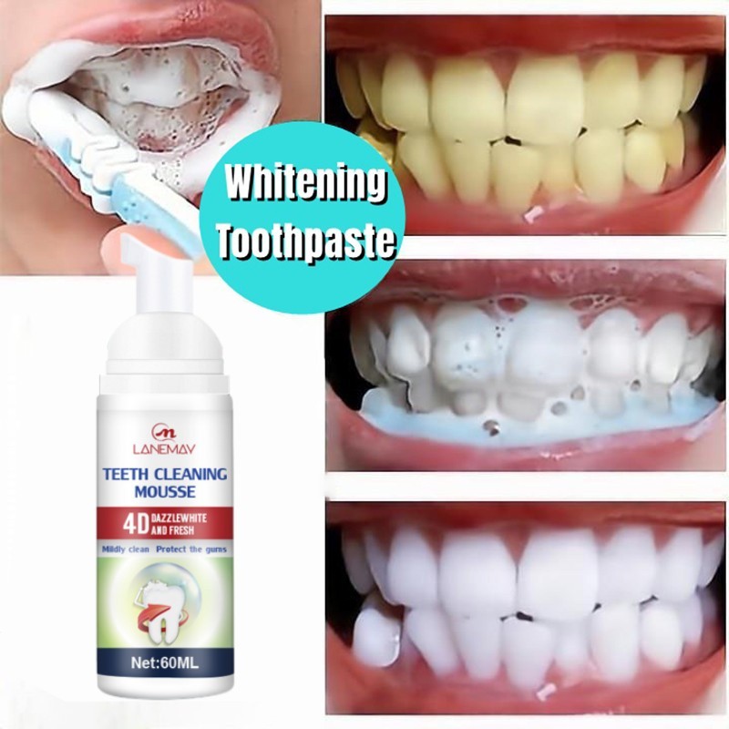Unique Teeth Whitening Toothpaste Tooth Cleaning Mousse 60ML Clean ...