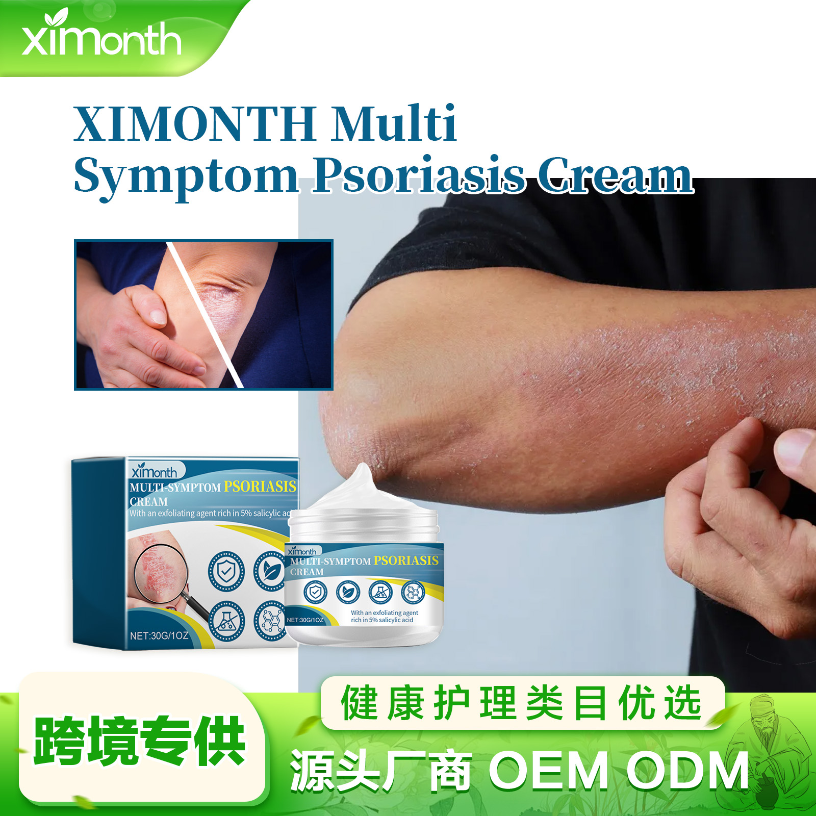 Psoriasis Treatment Ointment with Antibacterial and Anti-Itch Benefits ...