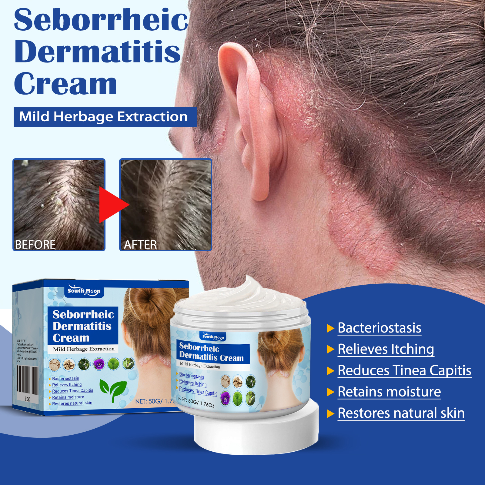 50g/Box Anti-itch Cream Non-irritating Healthy Safe Effective Anti ...