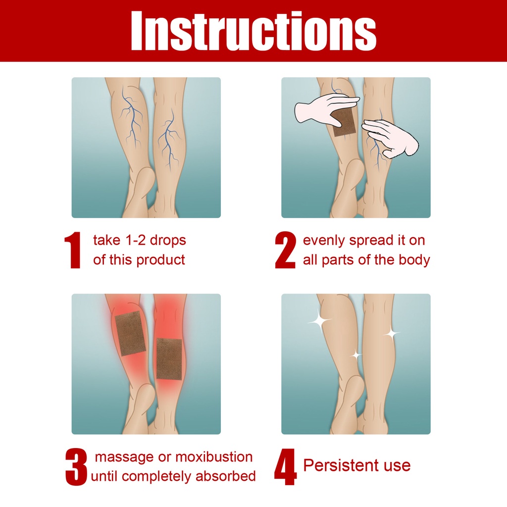Jaysuing Varicose Veins Patch Intravenous Remover Patch Varicose Vein ...