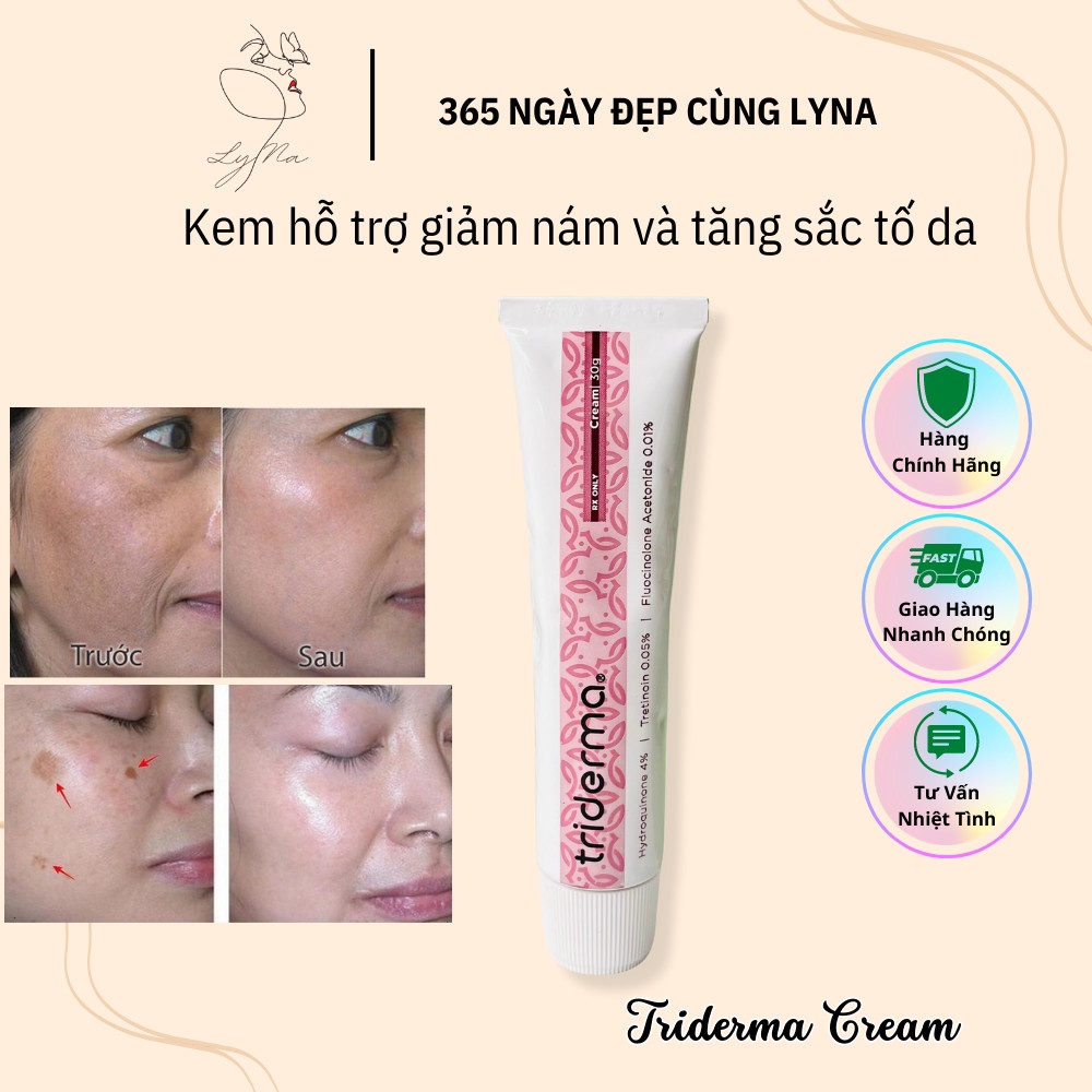 Triderma Cream Helps Reduce Pigmentation And Hyperpigmentation, Melasma