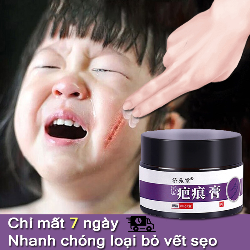 Face Scarring Cream 30g Keloid Cream Quickly Removes Scars Without