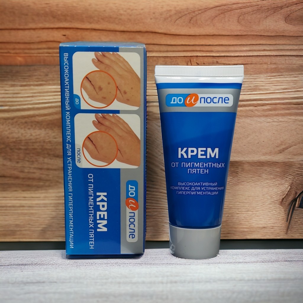 Hand Age Cream, Brown Spot Age Cream 50ml | Shopee Philippines