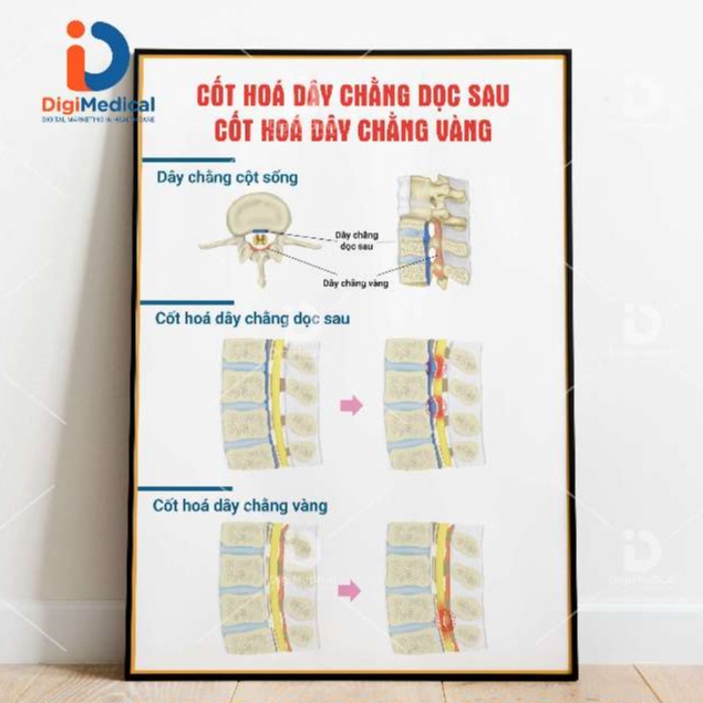 (Decal Sticker) Painting of Bones and Joints, Reinforced ligaments ...
